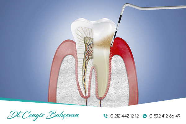 Anug Nedir