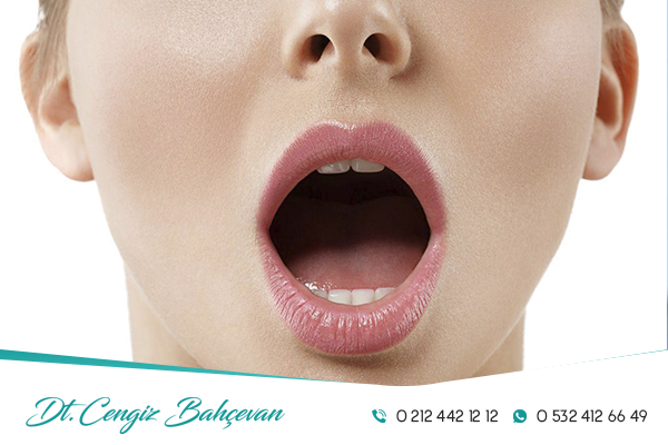 Bennet Haraketi Nedir