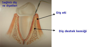 saglikli-dis-eti